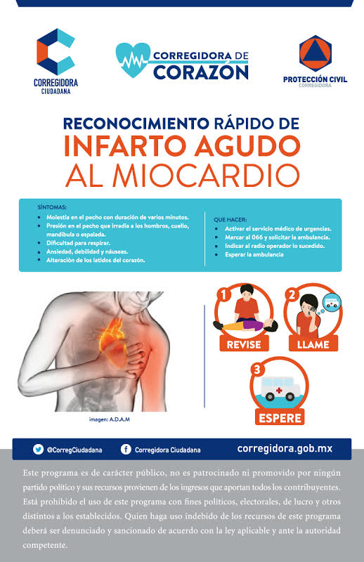 Reconocimiento rápido Infarto Miocardio